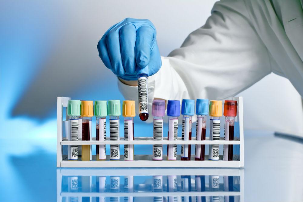 Exame Toxicológico: Saiba Como Funciona e Renove a CNH Sem Correr Riscos